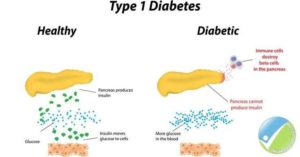 diabetes smart patch