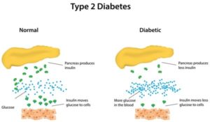 diabetes smart patch